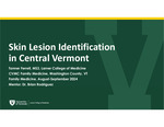 Skin Lesion Identification in Central Vermont by Tanner L. Ferrell